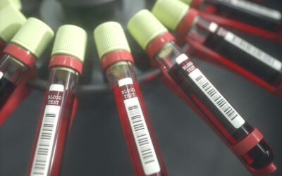 Lo que debes saber sobre los análisis de sangre